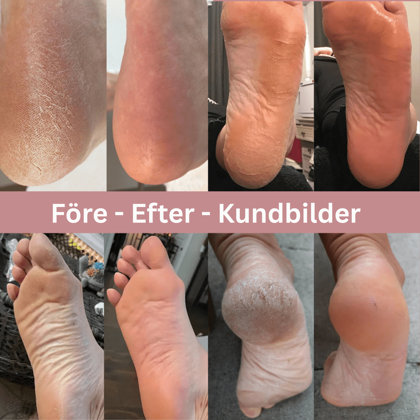 HudGlider™ – Slät hud på sekunder – utan irritation.