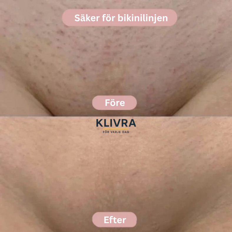 SilkyRak™ – För en behaglig och trygg rakningsupplevelse