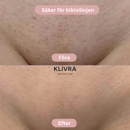 SilkyRak™ – För en behaglig och trygg rakningsupplevelse