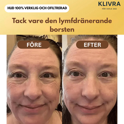 LymfGlow™ – Skonsam borstning som ger glöd och bättre cirkulation