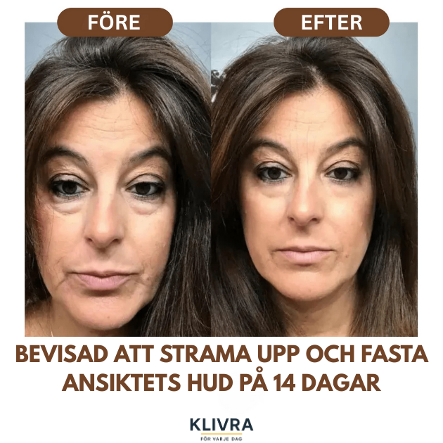 LymfGlow™ – Skonsam borstning som ger glöd och bättre cirkulation