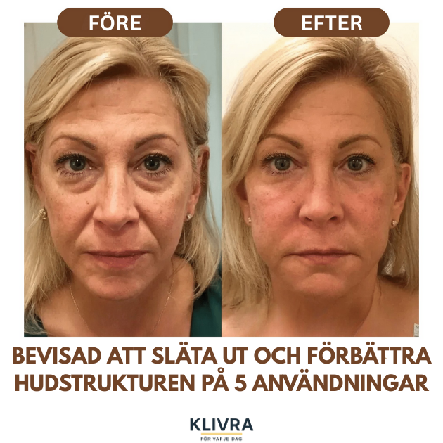 LymfGlow™ – Skonsam borstning som ger glöd och bättre cirkulation